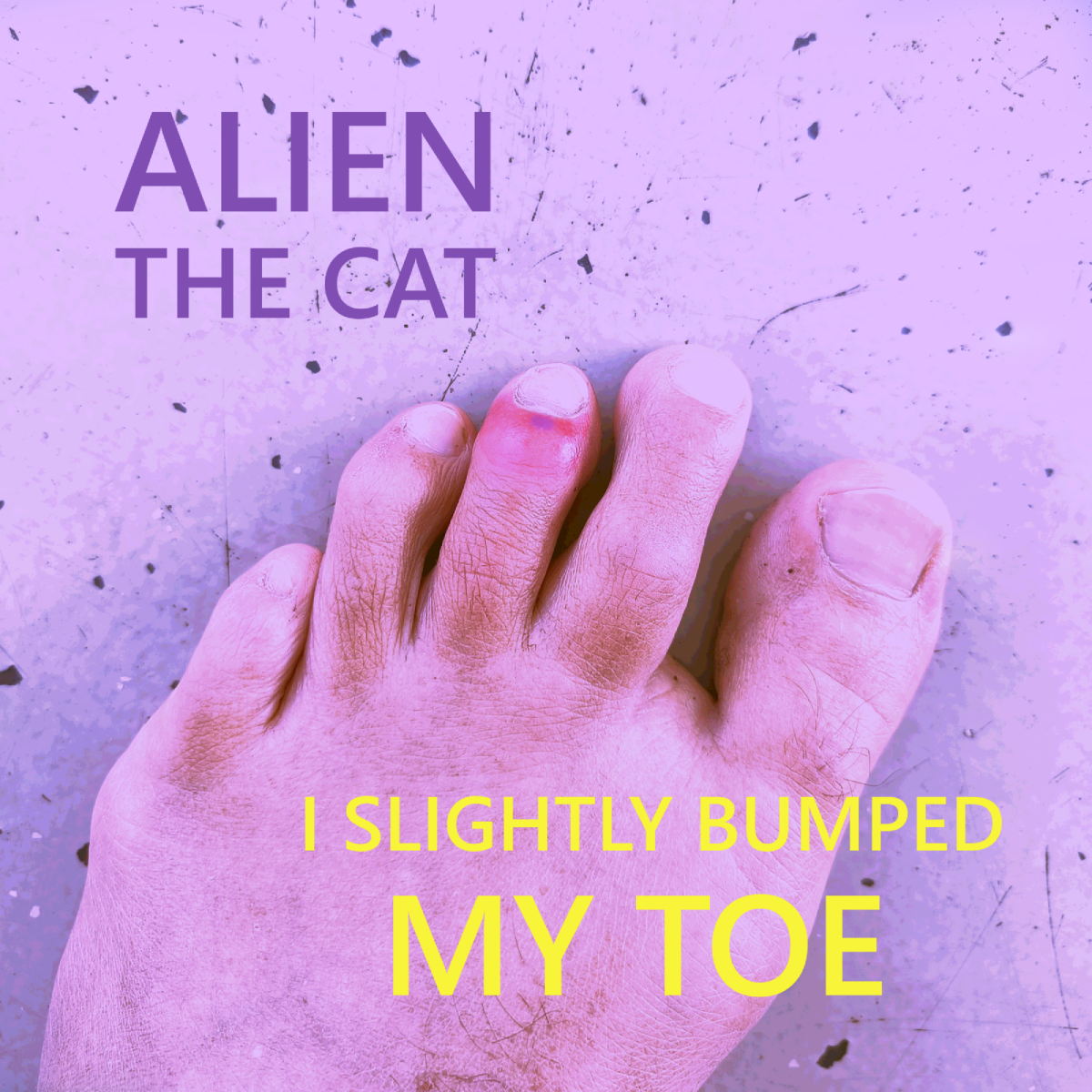 Slightly Bumped My Toe cover art